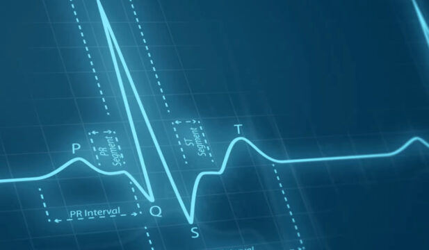 cerea-ecg-elettrocardiogramma-farmacia