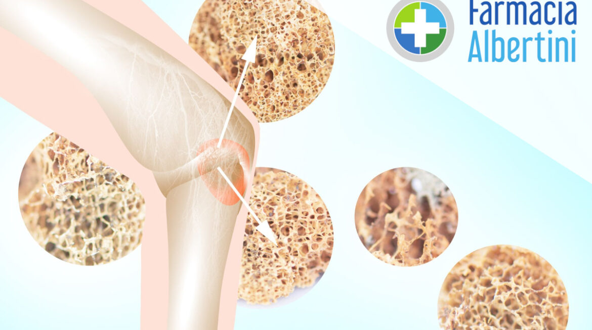 Giornata di Prevenzione dell’Osteoporosi del 25/03/2025